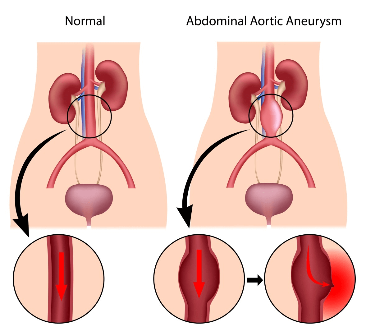 Abdominal